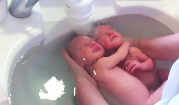 雙胞胎出生後第一次洗澡，依然緊緊相依1
