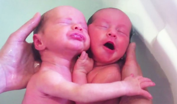 雙胞胎出生後第一次洗澡，依然緊緊相依5