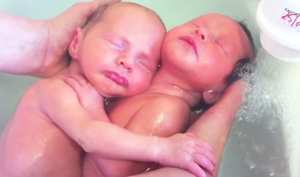 雙胞胎出生後第一次洗澡，依然緊緊相依7