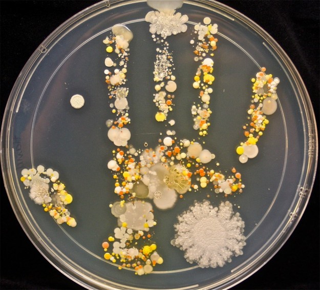手掌細菌1